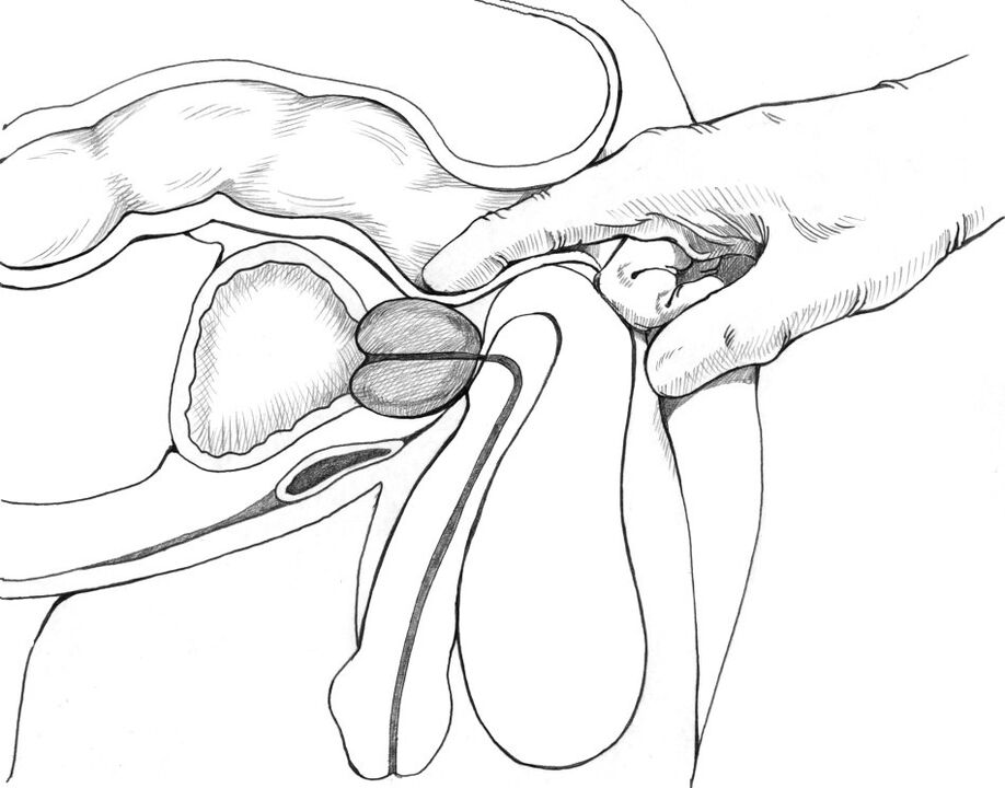 Prostate massage is included in the comprehensive treatment method for prostatitis